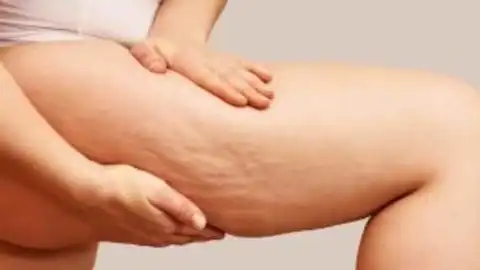 Best Place to Inject Mounjaro for Weight Loss and How to Avoid Common Errors